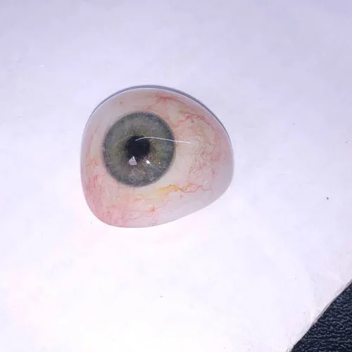 کلینیک چشم مصنوعی ماهان - پروتز چشم - چشم مصنوعی