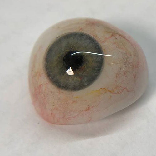 کلینیک چشم مصنوعی ماهان - پروتز چشم - چشم مصنوعی