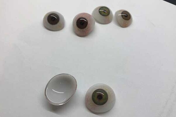 بهترین مرکز چشم مصنوعی