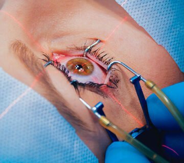 جراحی فمتولیزیک