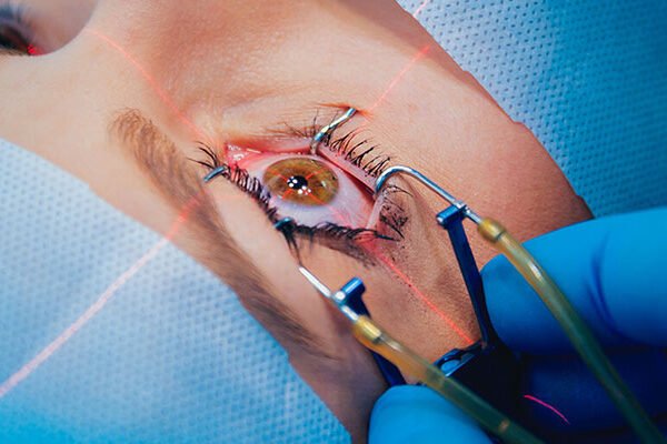 جراحی فمتولیزیک