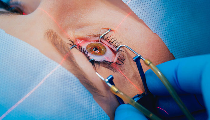 جراحی فمتولیزیک