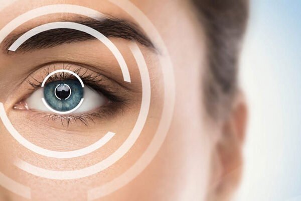 ریلکس اسمایل