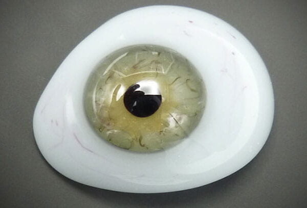 محدودیت برخی افراد در استفاده از پروتز چشم