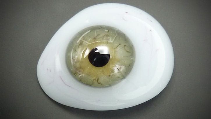 محدودیت برخی افراد در استفاده از پروتز چشم