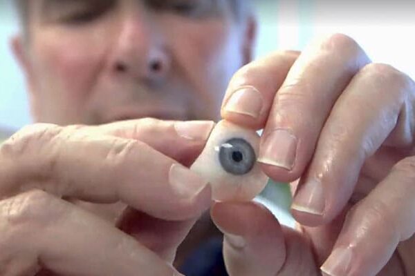 تجربیات افراد دارای چشم مصنوعی