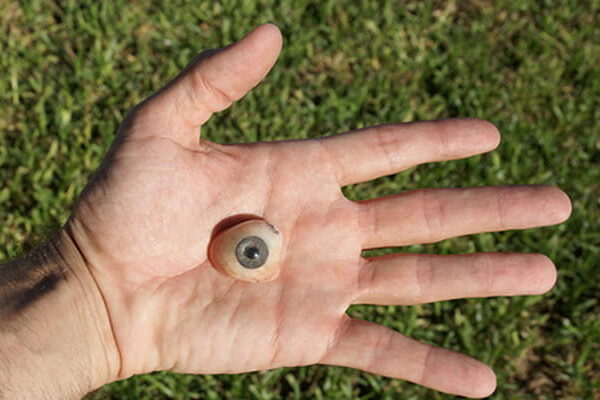 باورهای غلط درباره چشم مصنوعی