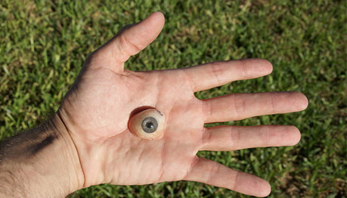 باورهای غلط درباره چشم مصنوعی