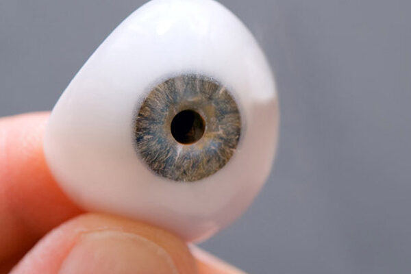 تفاوت پروتز چشم سفارشی و پروتز چشم آماده