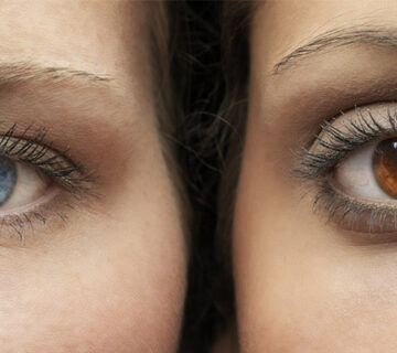 عمل تغییر رنگ چشم